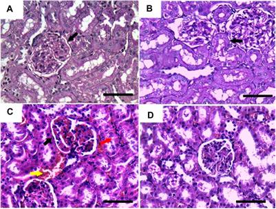 Annona Muricata L. extract restores renal function, oxidative stress, immunohistochemical structure, and gene expression of TNF-α, IL-β1, and CYP2E1 in the kidney of DMBA-intoxicated rats